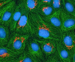 Image of cultured HeLa cells.  Courtesy of the National Institutes for Health